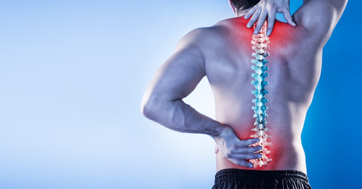 Physiotherapy for Back Pain: Does It Really Work?