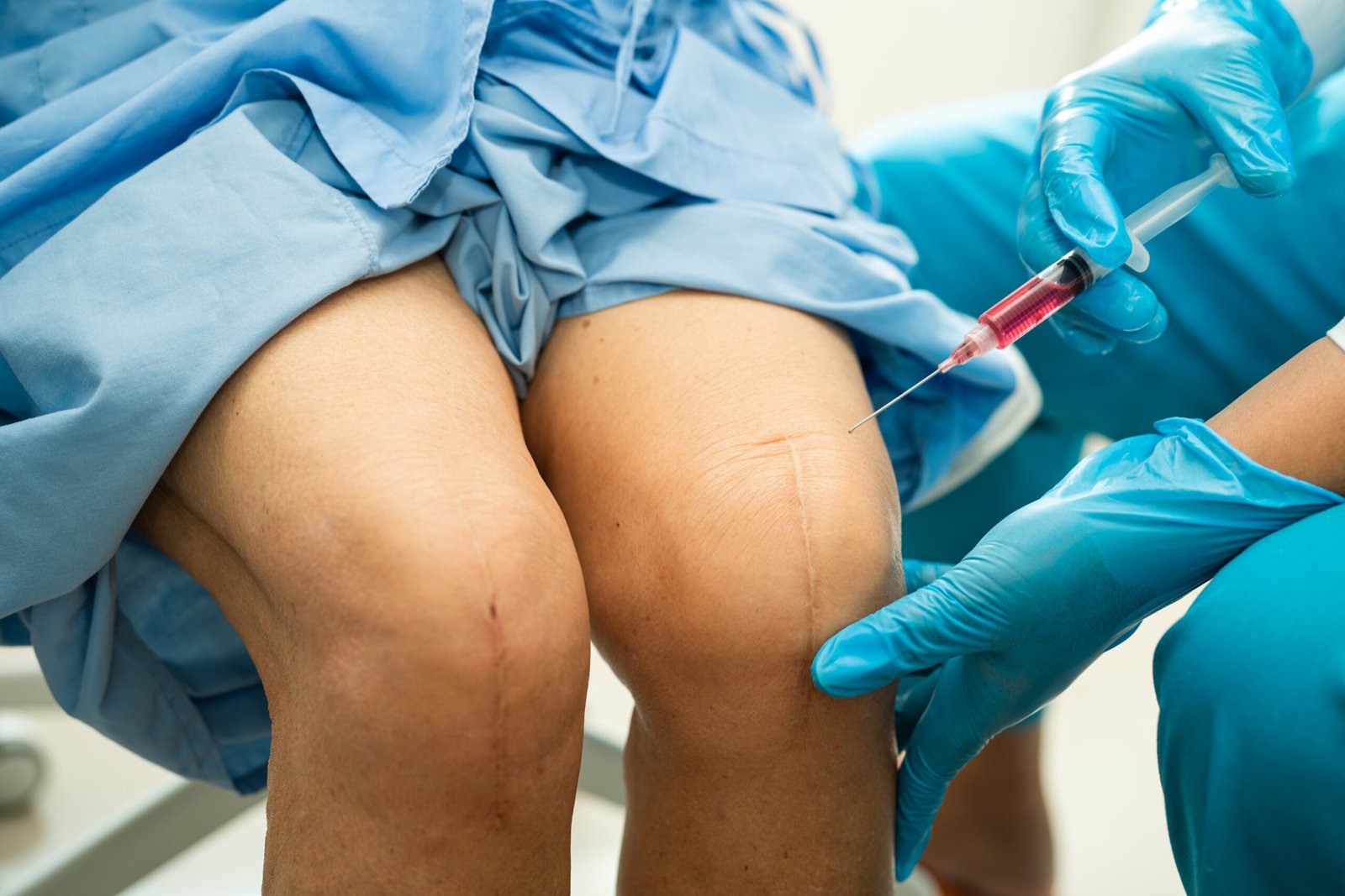 Joint Pain Treatment Bangalore