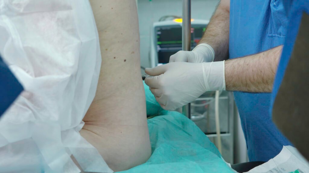 Current image: Intra-Articular Injections