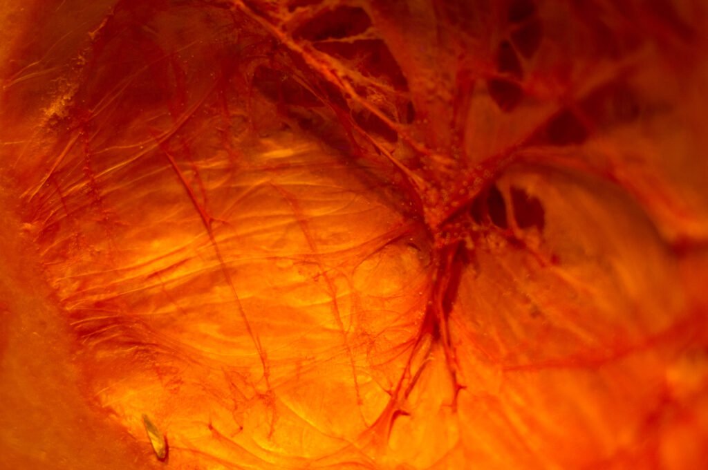 Current image: Nerve Root Block